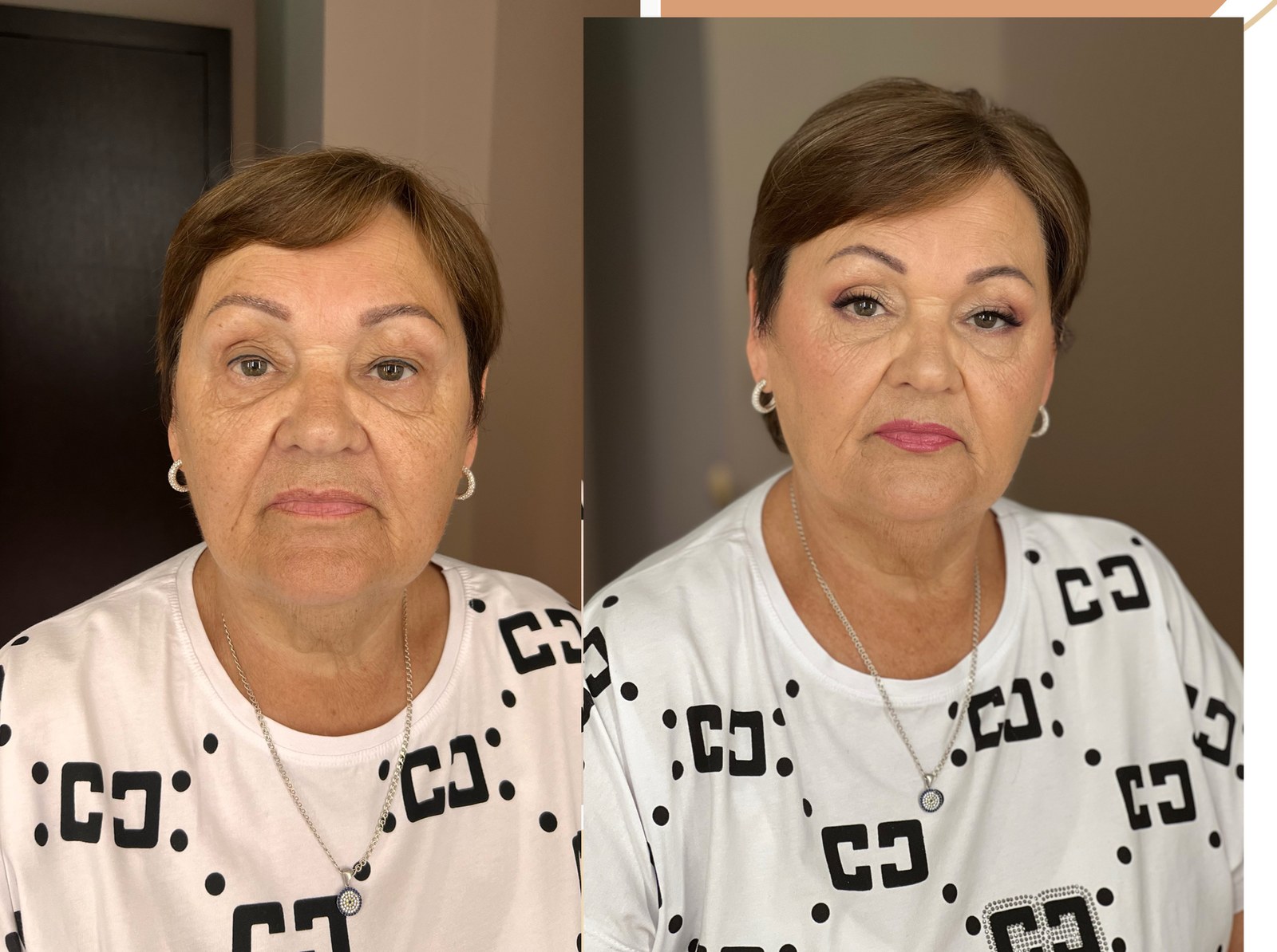 Lifting ličenje – pred in po